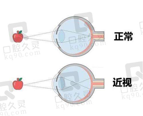 阳泉爱维视眼科门诊部预约挂号流程：