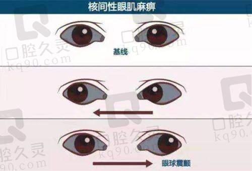新疆空军 医院眼科半飞秒与全飞秒技术优势对比