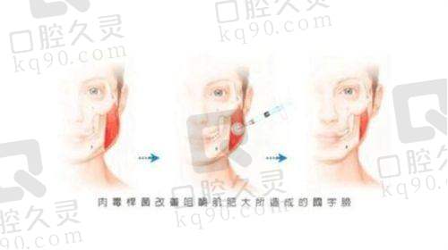 宜宾天使之翼医疗美容门诊部咋样？特色项目、医生实力和排名优势告诉你答案