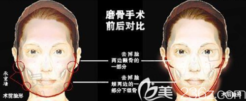 与多机构合作的优势