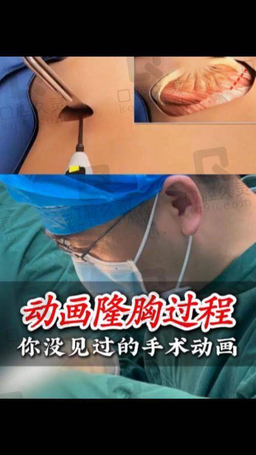 自体脂肪隆胸的“术后不适”谣言