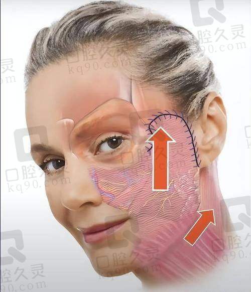 北京加减美是正规医院，具备专业资质与资深医师团队，整形服务有保障 