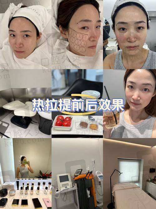 上海伯思立袁智娟热拉提全面部/颈部仅363元 享专业医美焕肤紧致体验