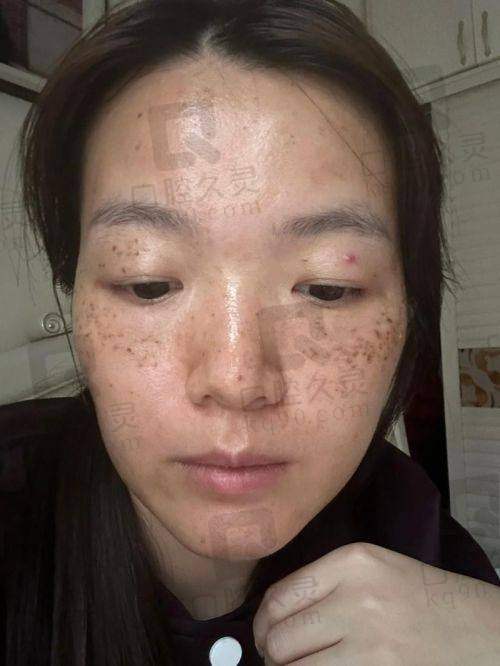 廊坊华康医疗美容医院：成立于2002年，是廊坊地区有实力的私立美容整形专科机构。医院规模相对较大，拥有充足的营业空间和完善的科室建设。聘请了一大批技术水平较高的医生，护理人员也都接受过正规的培训和考核。在激光祛斑领域，凭借其专精的技术和优质的服务，赢得了患者的信任。