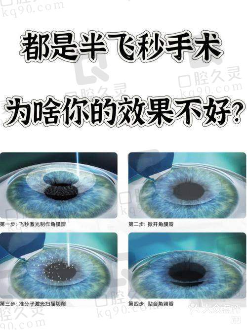 汕尾爱尔眼科医院的近视手术成效