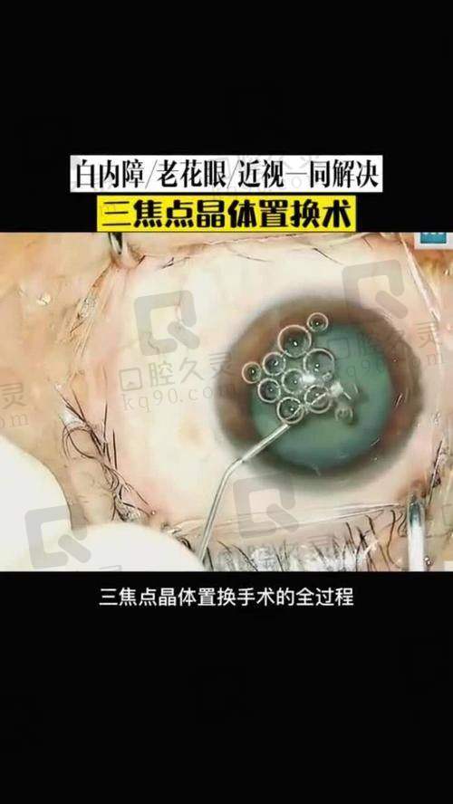 台州爱尔眼科医院综合服务优势
