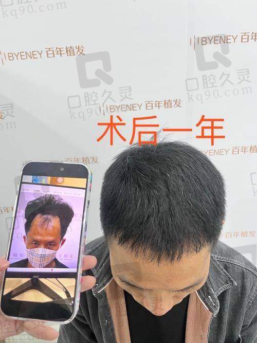 手术过程是怎样的体验？