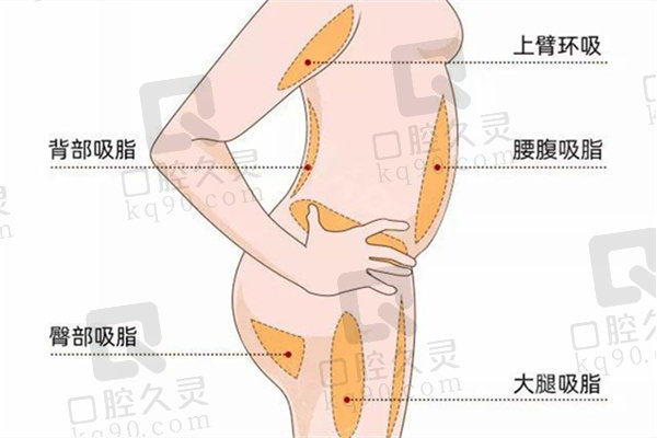 2025年深圳吸脂医生排名及技术优势汇总！顺便看深圳吸脂手术多少钱