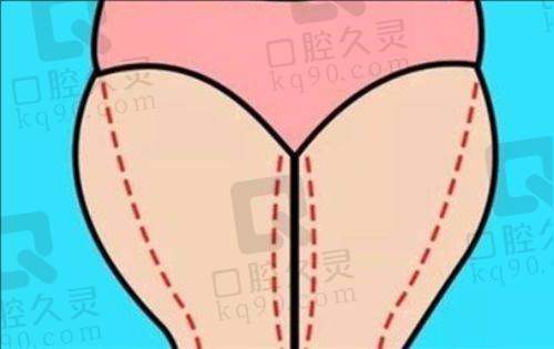 患者对遵义利美康整形美容医院的评价如何？