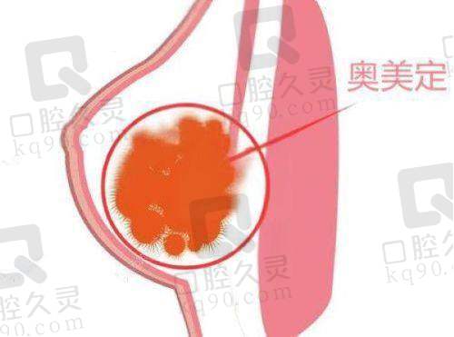 哈尔滨羽禅的异物取出费用合理吗？