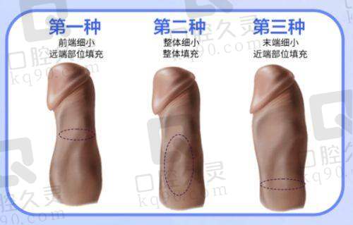 患者对张辉医生做鼻子的评价如何？