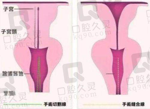 广州美莱医疗美容医院——接轨国内外的时尚之选