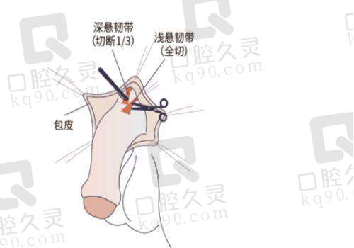 东莞东城紫芯医疗美容的口碑评价