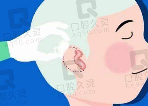 家人们谁懂！成都八大处章庆国做耳朵再造超神，5万让娃拥有逼真耳朵