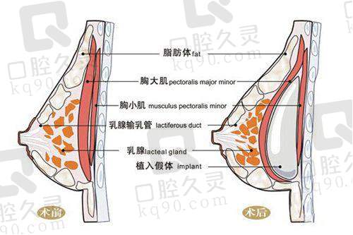 罗永华医生特色技术优势