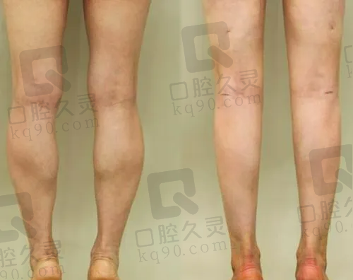 大同曼姿医疗美容诊所患者评价：