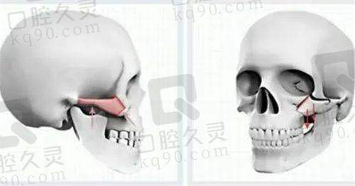 深圳美莱整形医院在哪里？医院位置详细介绍：交通便利、地址清晰，位于深圳市福田区深南中路，轻松预约整形服务！