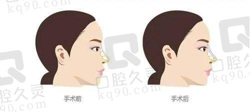 2. 成都米兰柏羽眼部整形项目