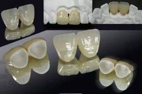 环中口腔未来发展趋势如何？值得选择吗？