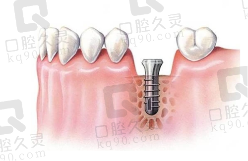 2. 石家庄美年美华口腔医院