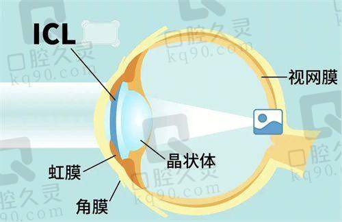 宿州润视眼科医院的服务与口碑