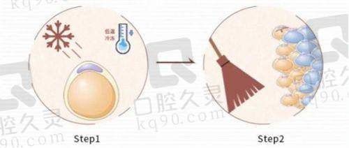 4. 天津美莱医学美容医院隆胸手术费用