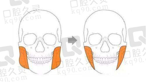 六、大同景然医疗美容诊所患者评价：