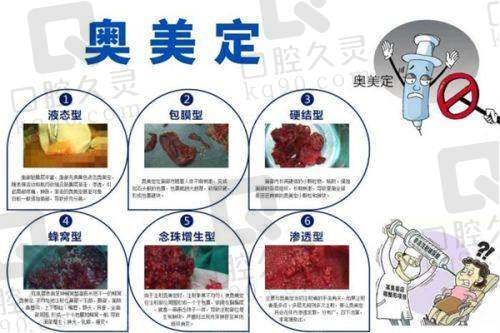 成都华美紫欣馨和米兰柏羽哪家好？医生简介、手术项目的价格、患者实例分享等方面对比分析