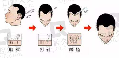 五、厦门万禾丽生植发医生介绍