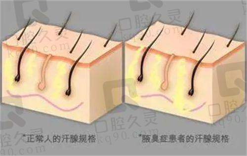 珠海韩妃各整形项目优势解析