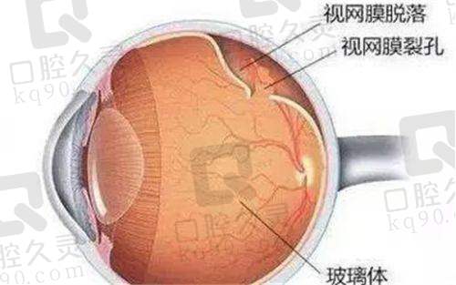 2025贵阳佰视佳眼科医院收费标准揭秘，全飞秒10800起，白内障3968起