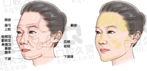 六、深圳美莱整形医院的收费价目表