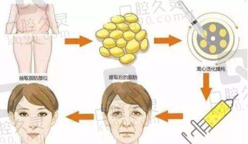 六、手术费用一览：价格透明化对比