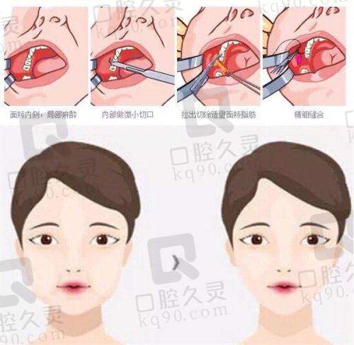 五、厦门华美名媛医疗美容门诊部怎么预约：