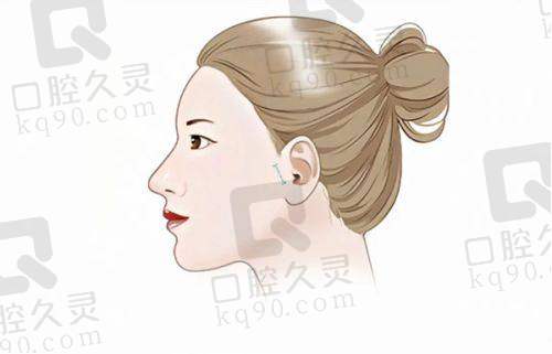 深圳美莱的行业定位及影响