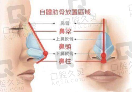 广州华美医疗美容医院——口碑良好的整形医院