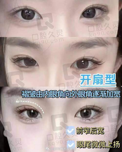 三、昆明陈曦医生的擅长项目