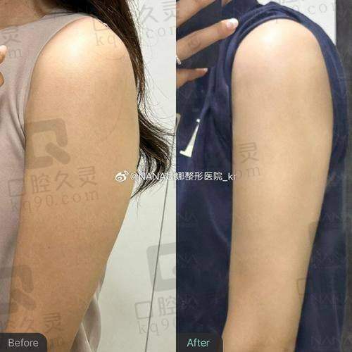 三、黄海侠医生坐诊的深圳艺星医疗美容医院怎么样？医院情况大介绍