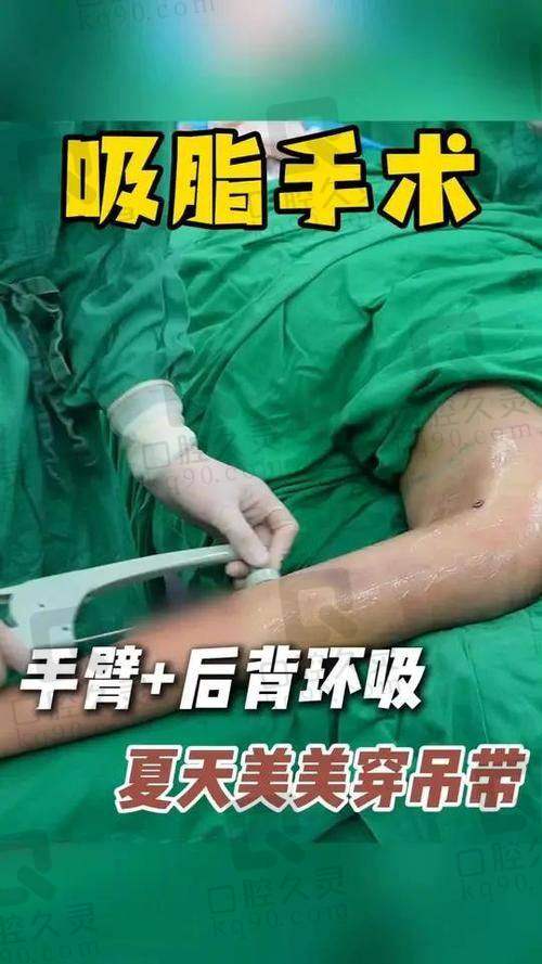 广州军美整形王世虎院长手术：安心体验显实力
