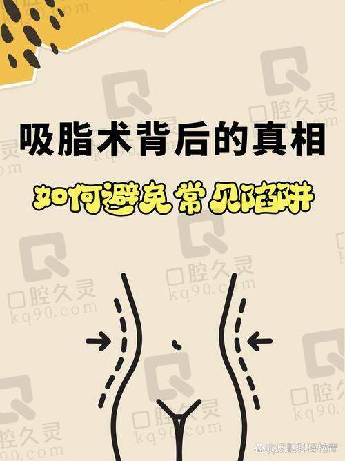 广州军美整形王世虎院长总结：成功上岸超满意