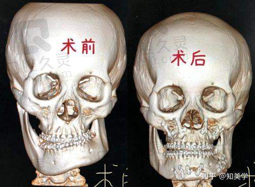 广州广大医院预约挂号攻略：电话、在线、到院多种方式，正颌手术医生何锦泉坐诊信息一览