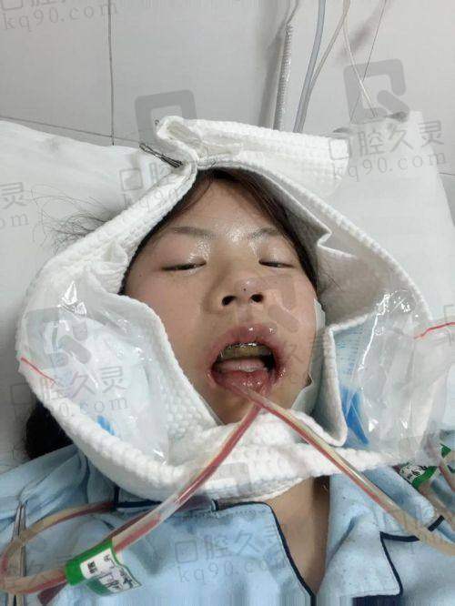 二、广州广大医院特色手术项目