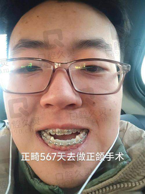 广州广大医院正颌哪个医生做得好？医生推荐何锦泉等专家，用户真实反馈与价格解析
