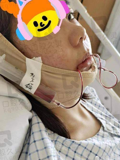五、患者关心问题解答