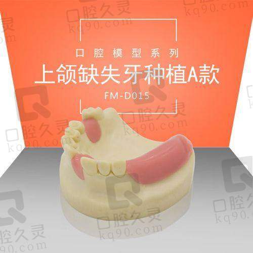 泉州美特尔口腔以色列雅定种植牙的技术优势有哪些？