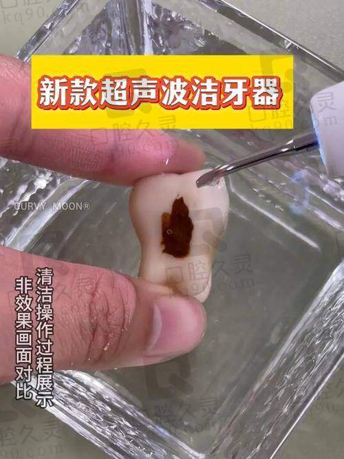上海泰康拜博口腔医院实力如何？
