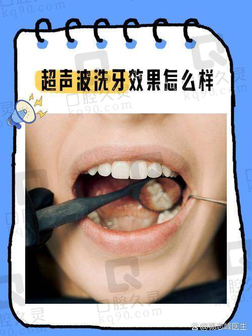 上海泰康拜博口腔医院PMTC深度洁牙适合哪些人群？