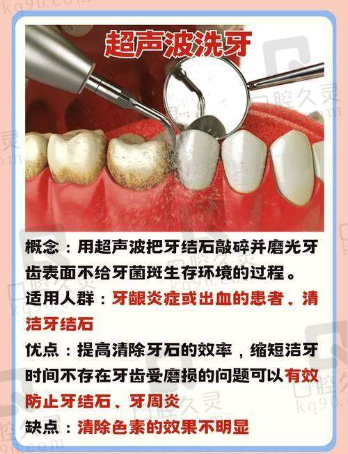 上海泰康拜博口腔医院PMTC深度洁牙580元起，多功效护齿还能改善口气超给力