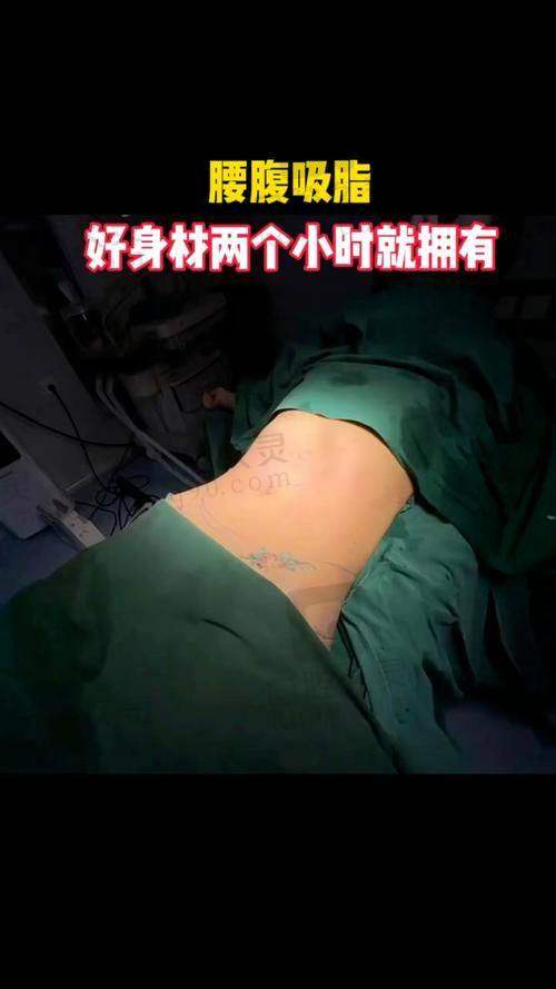 深圳画美医疗美容医院胡广孙医生