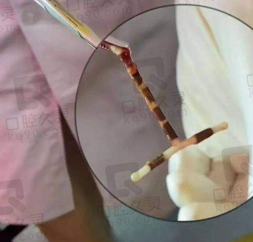 患者对哈尔滨羽禅的异物取出评价如何？